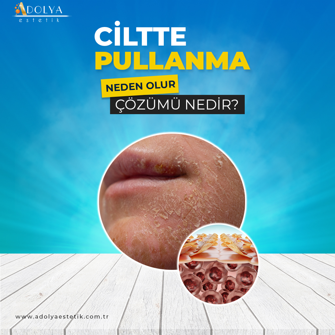 Ciltte Pullanma 