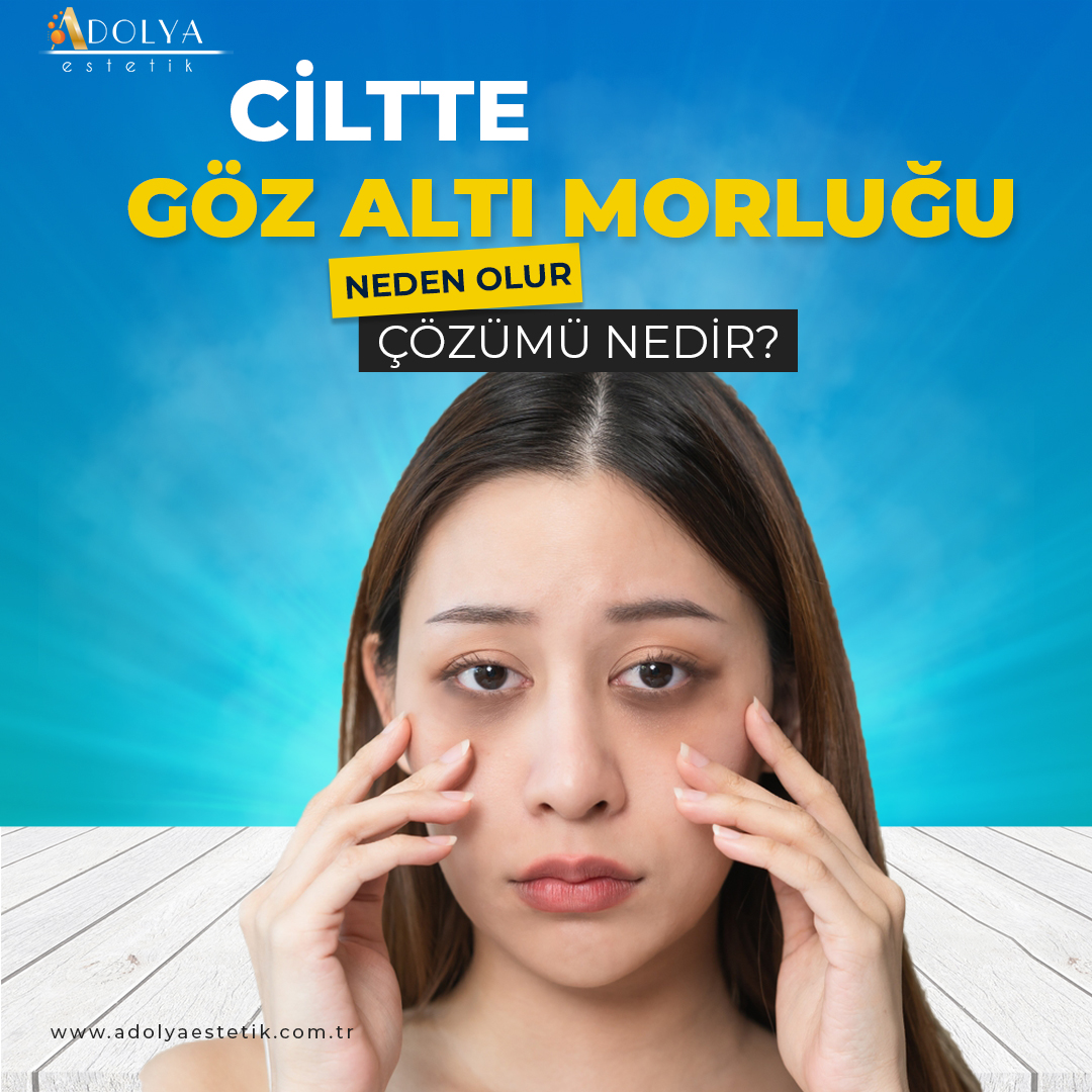 Göz Altı Morlukları 